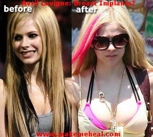 艾薇儿·拉维妮/Avril Lavigne-8-43